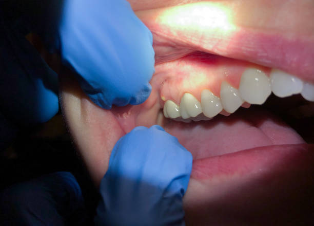 Best Orthodontic Emergency Dentist in State Line, PA